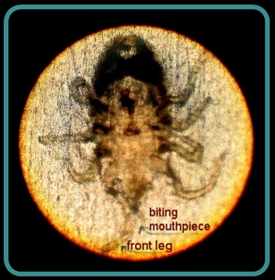 bird mite image