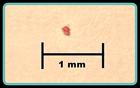 bird mites life cycle